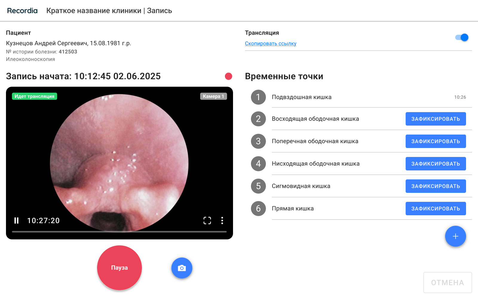 Экран записи колоноскопии с помощью Recordia